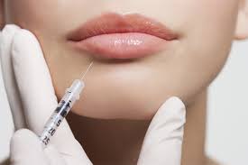 Injection de botox lèvres